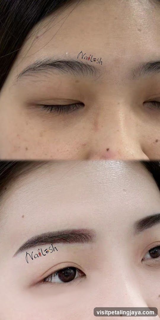 Eyebrow Before and After