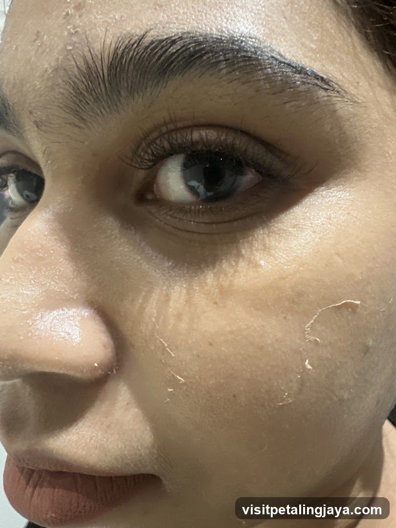 Close-up of a person's face with peeling skin