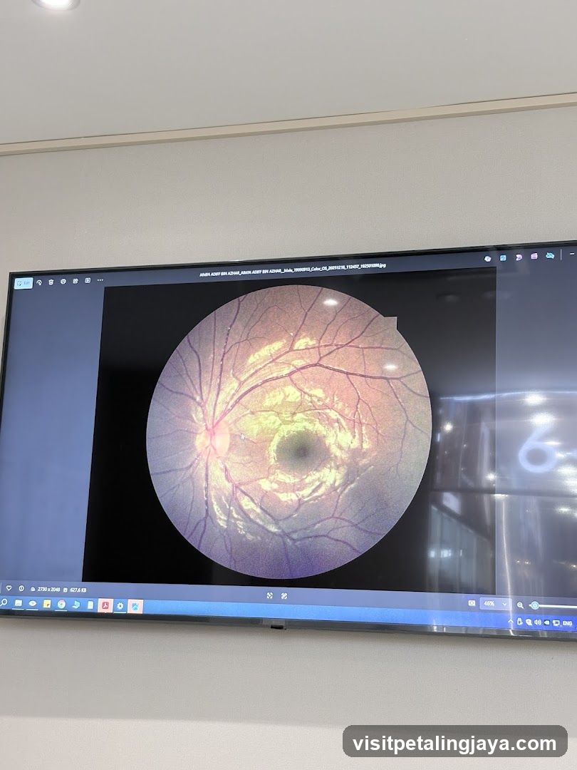 Retinal Scan Displayed on Screen