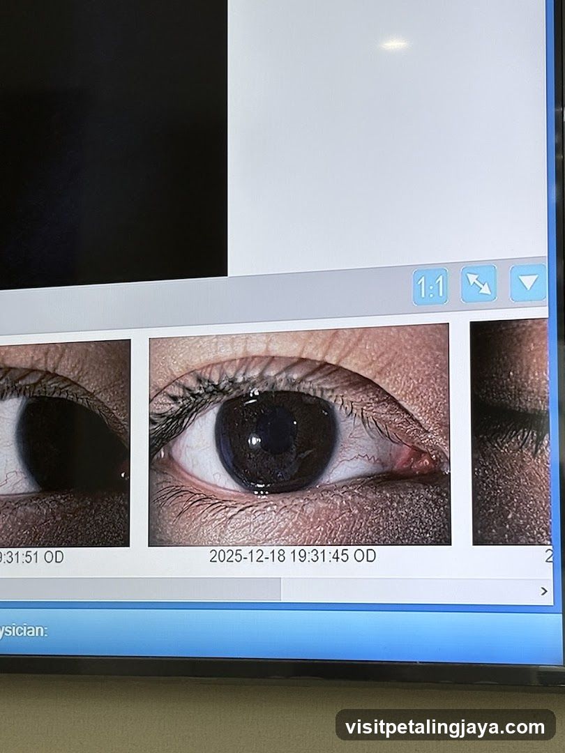 Eye Examination Images