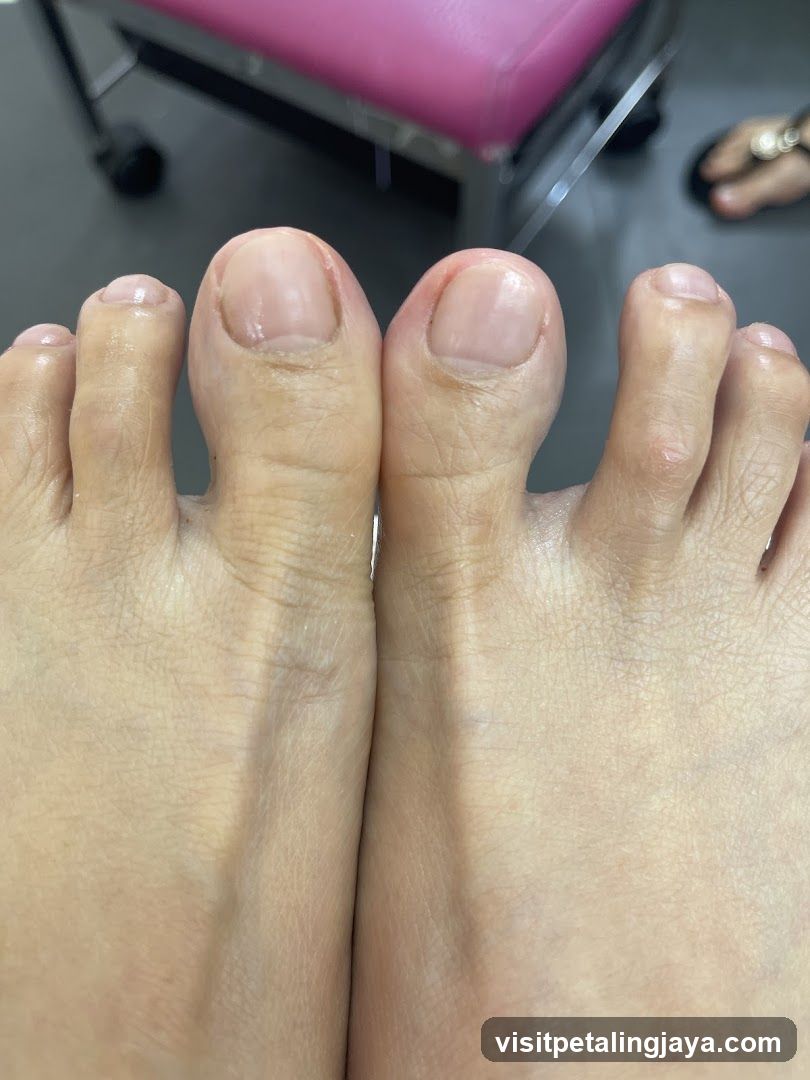 Close-up of Toes