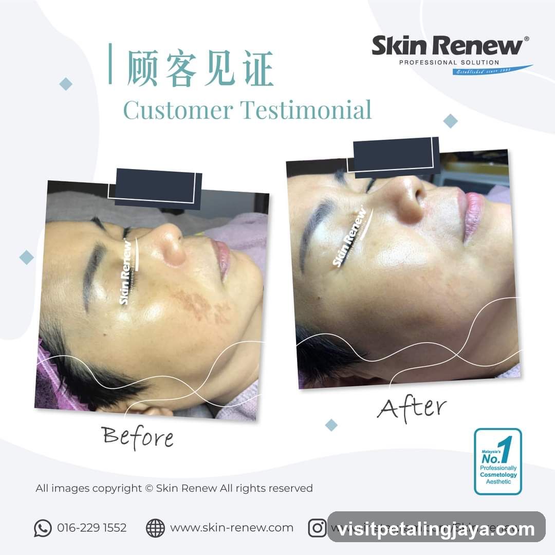 Skin Renew Customer Testimonial