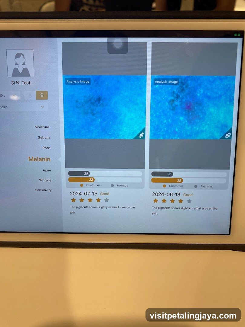 Skin Analysis App Interface