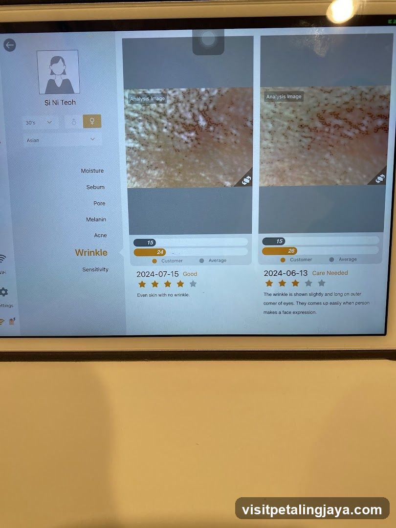 Skin Analysis App Interface