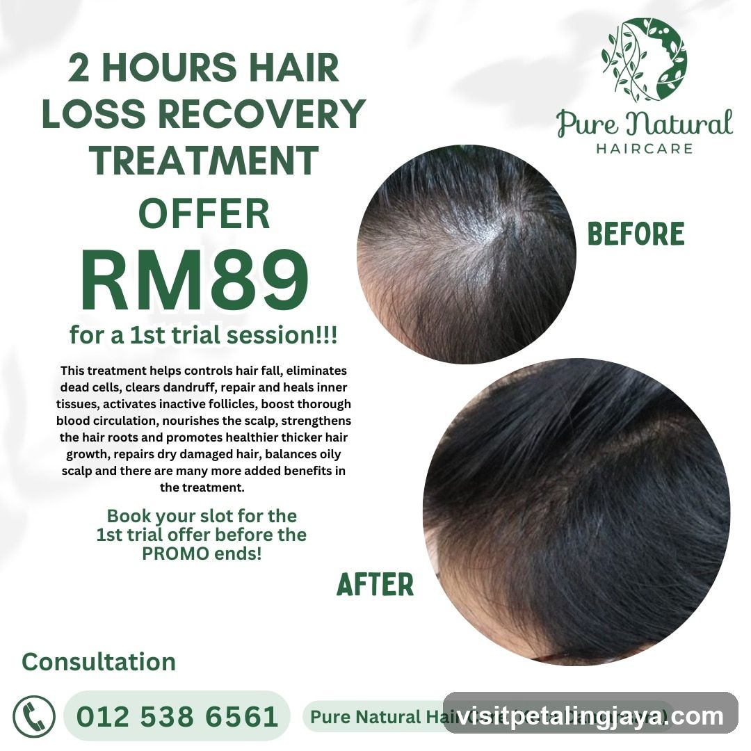 Hair Loss Recovery Treatment Offer