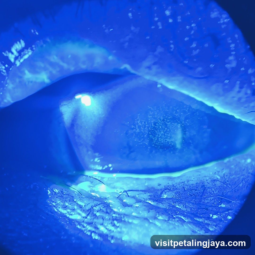 Blue-lit eye close-up