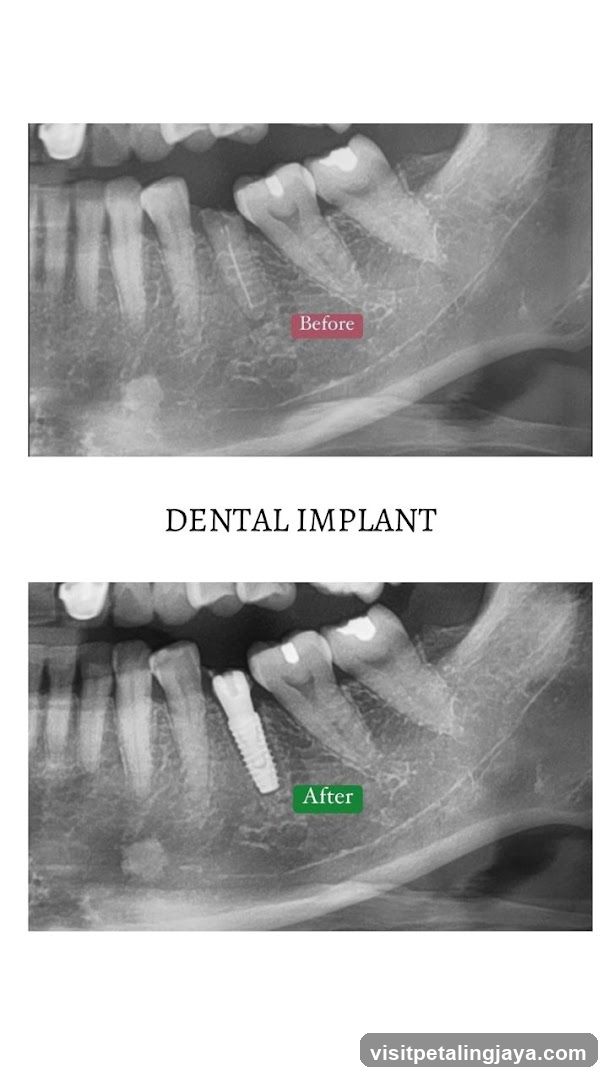 Dental Implant X-ray Comparison