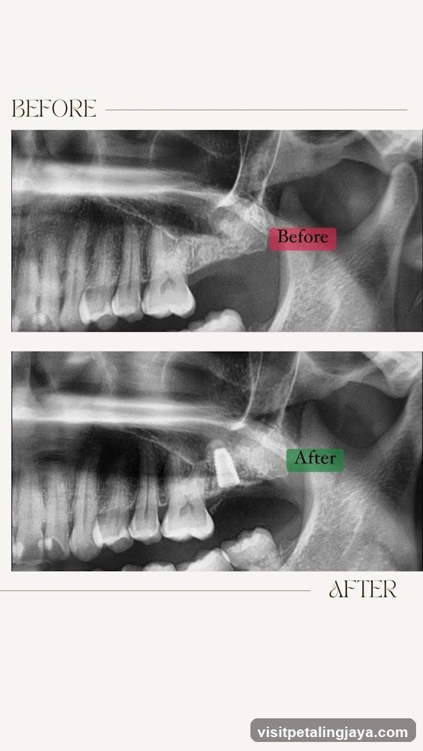 Dental X-ray Before and After