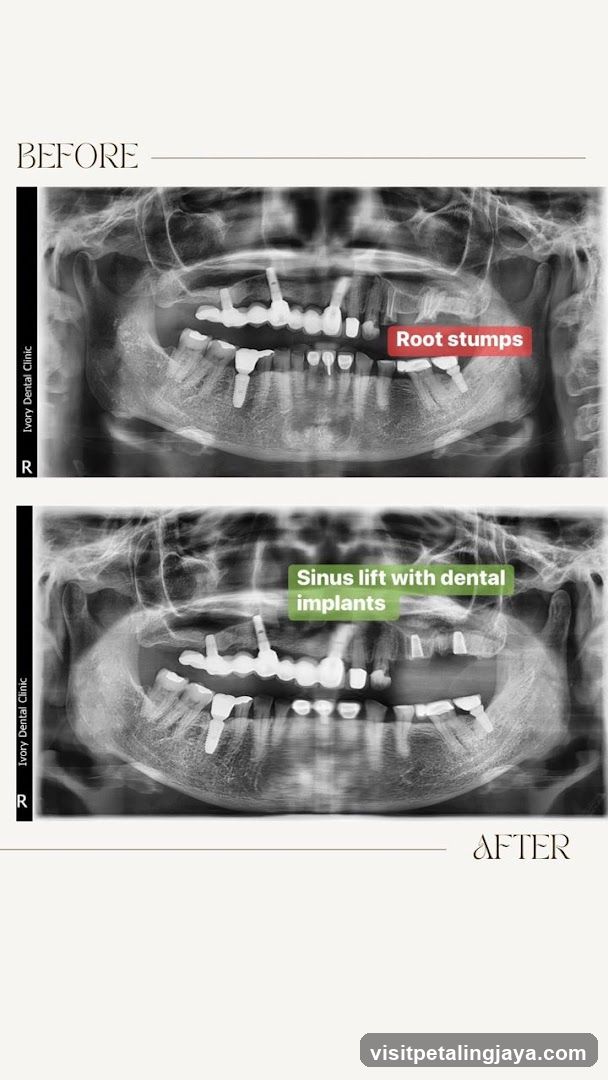 Dental X-ray Before and After