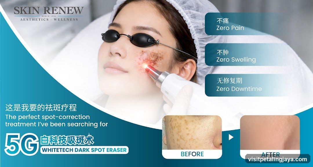Skin Renew - Spot Correction Treatment Ad