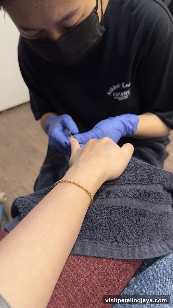 Hand Treatment Session