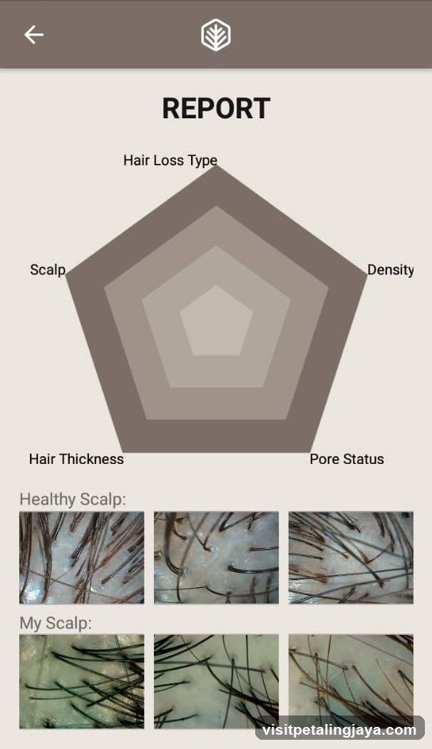 Hair Health Report