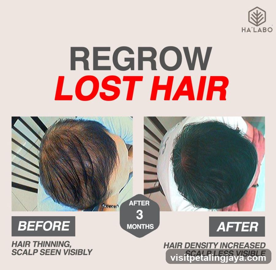 Regrow Lost Hair Ad