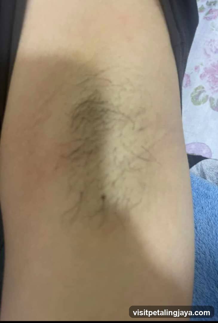 Body with hair on skin