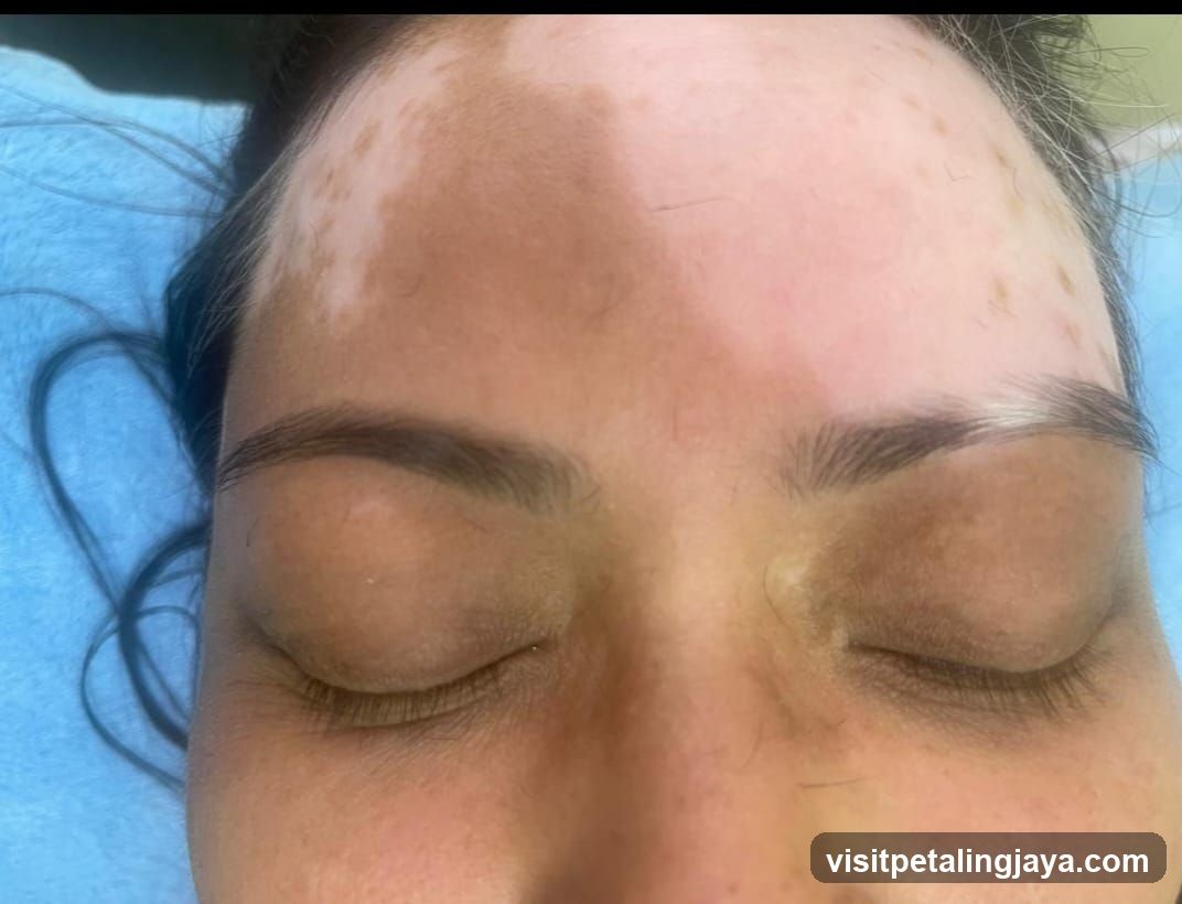 Face with skin condition