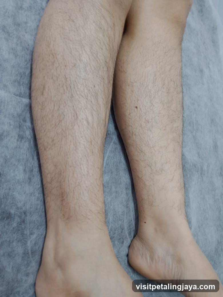 Legs on Examination Table