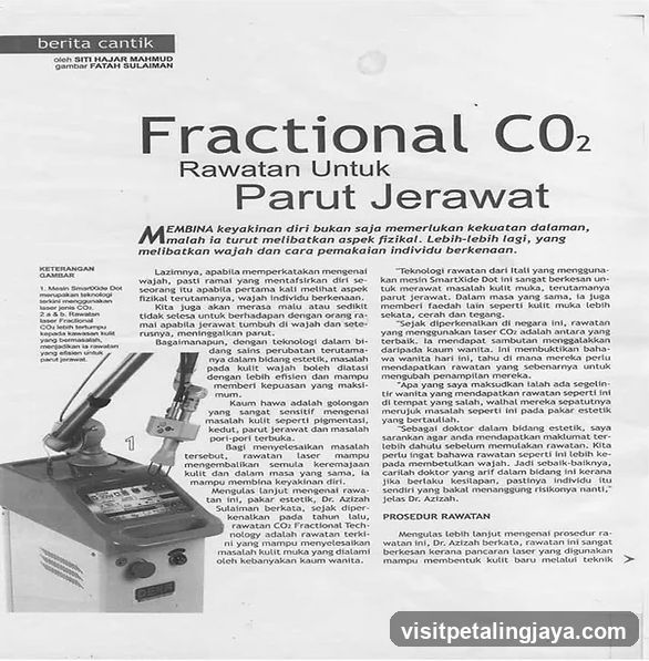 Frasional CO2 - Rawatan Untuk Parut Jerawat