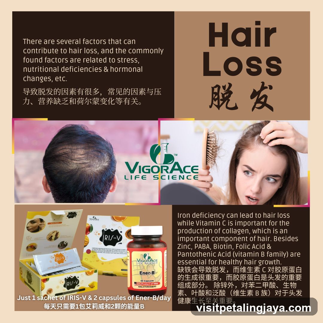 Hair Loss Infographic