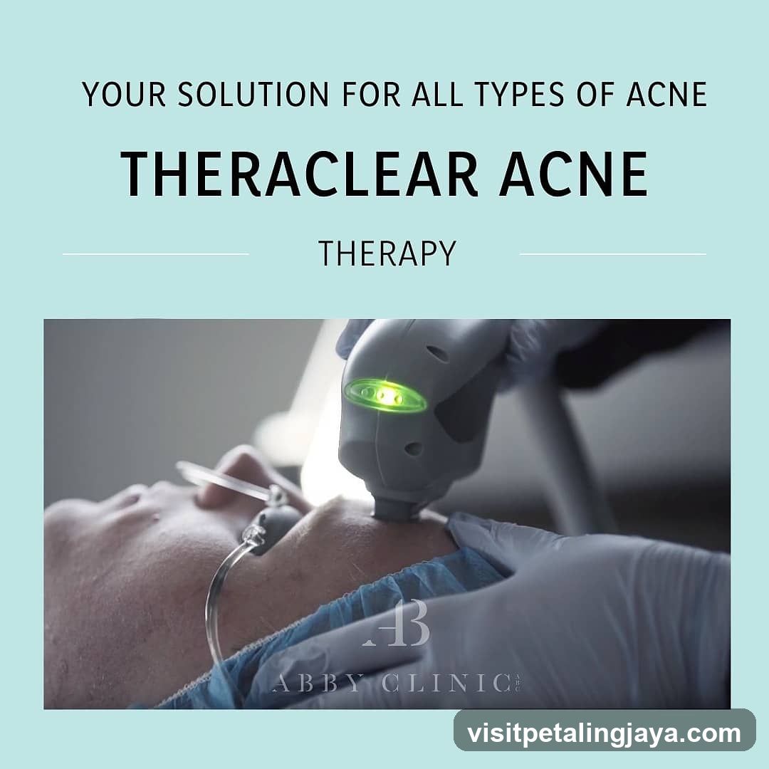 TheraClear Acne Therapy