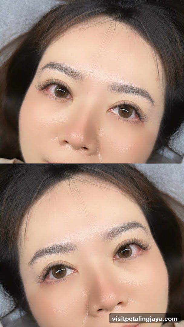Beauty Treatment Before and After