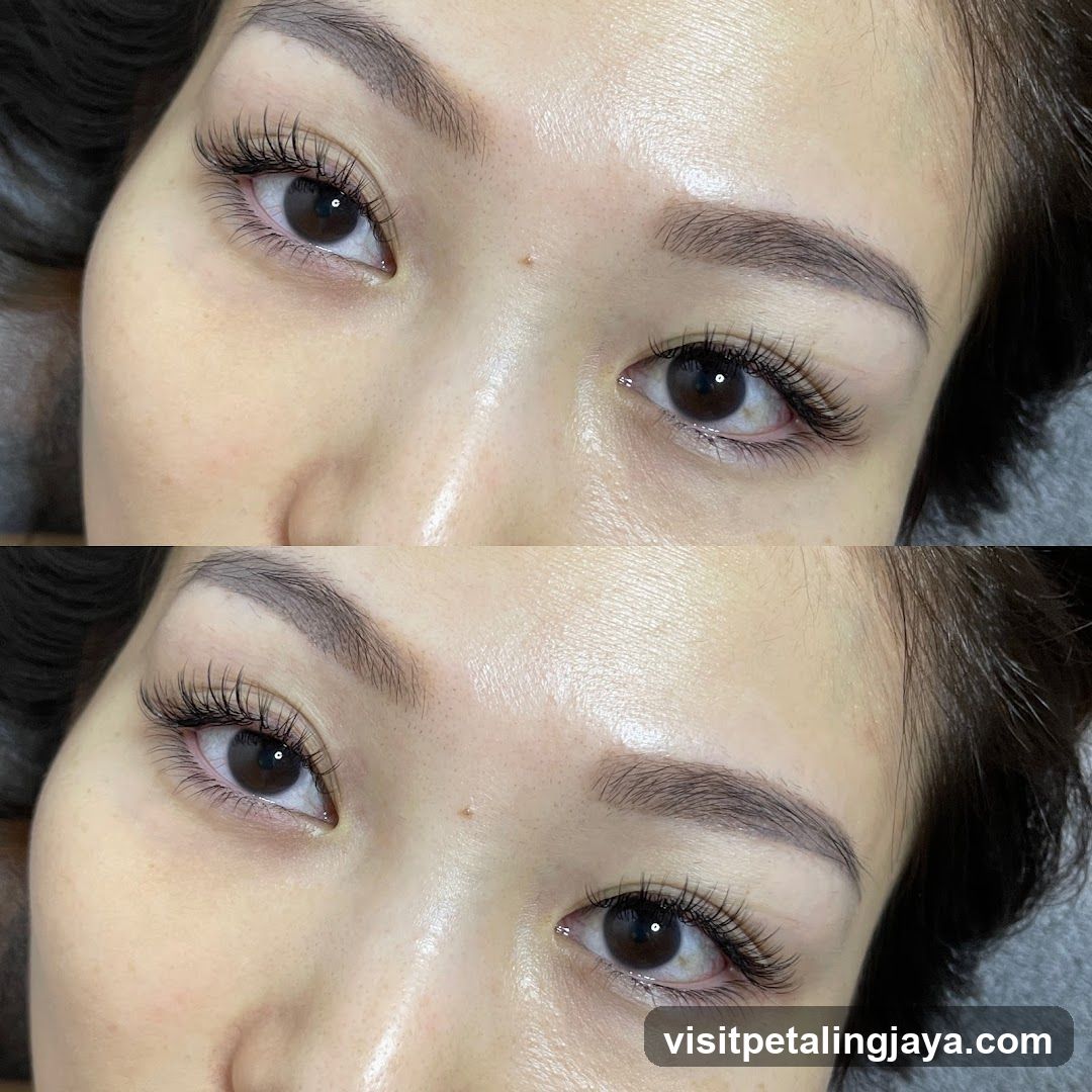 Beauty Treatment Before and After