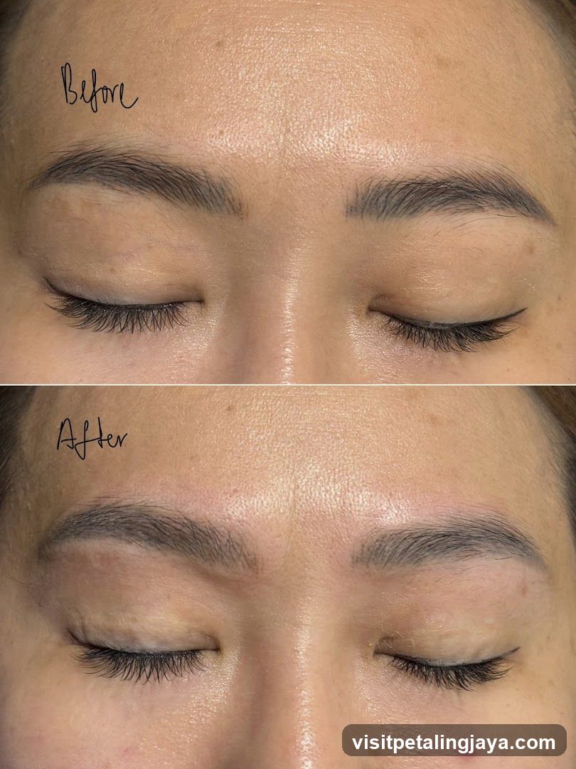 Before and After Eyebrow Treatment