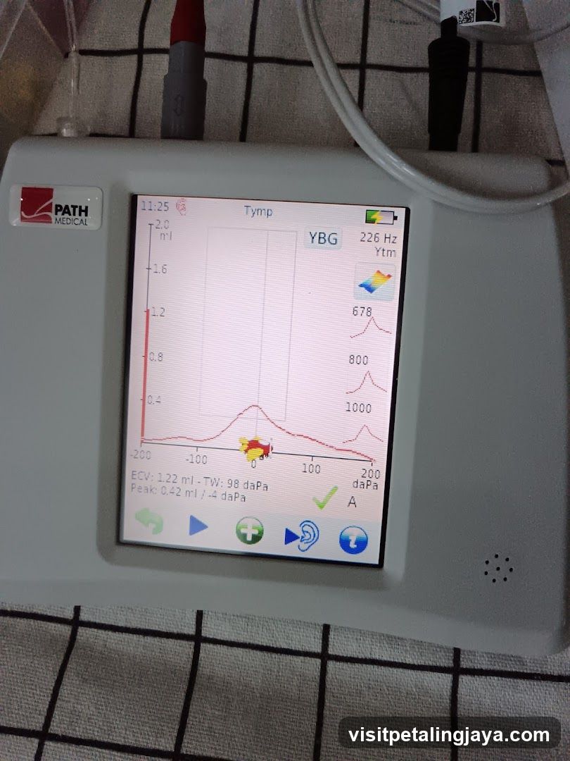 Tympanometry Monitor Display