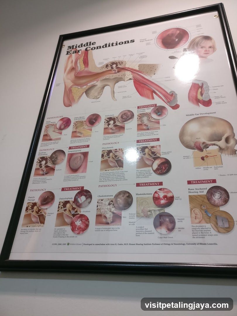 Middle Ear Conditions Educational Poster