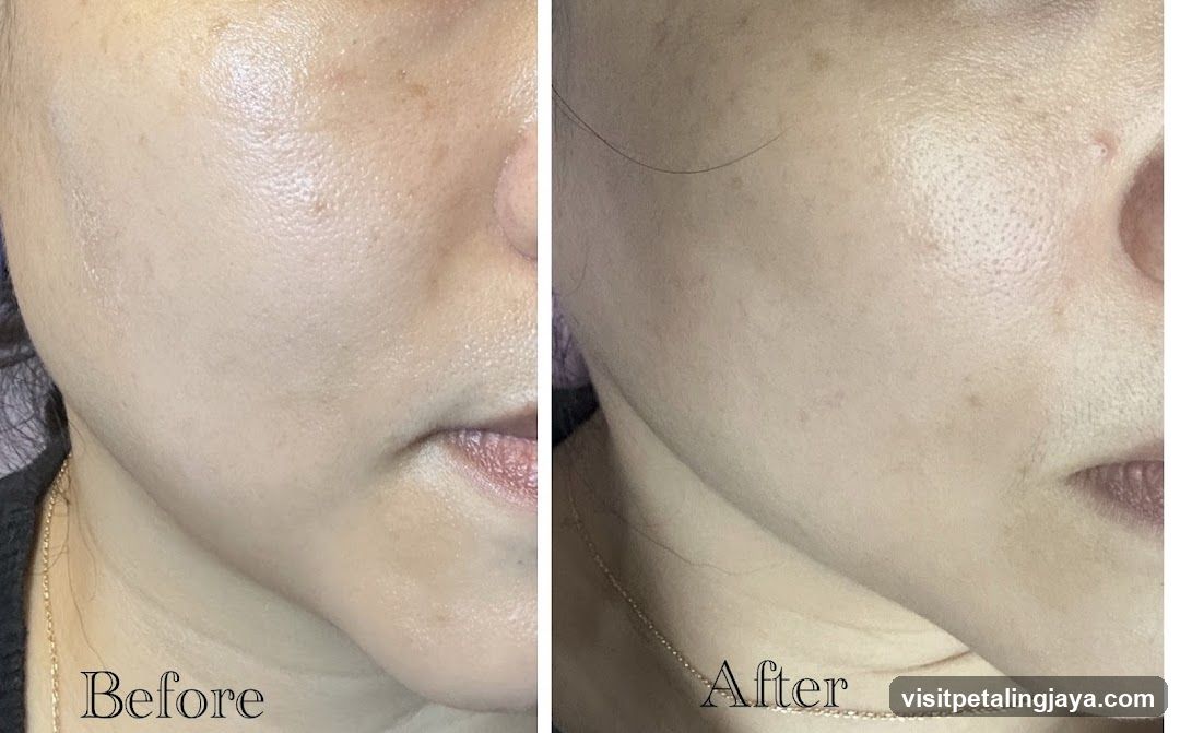 Skin Comparison Before and After