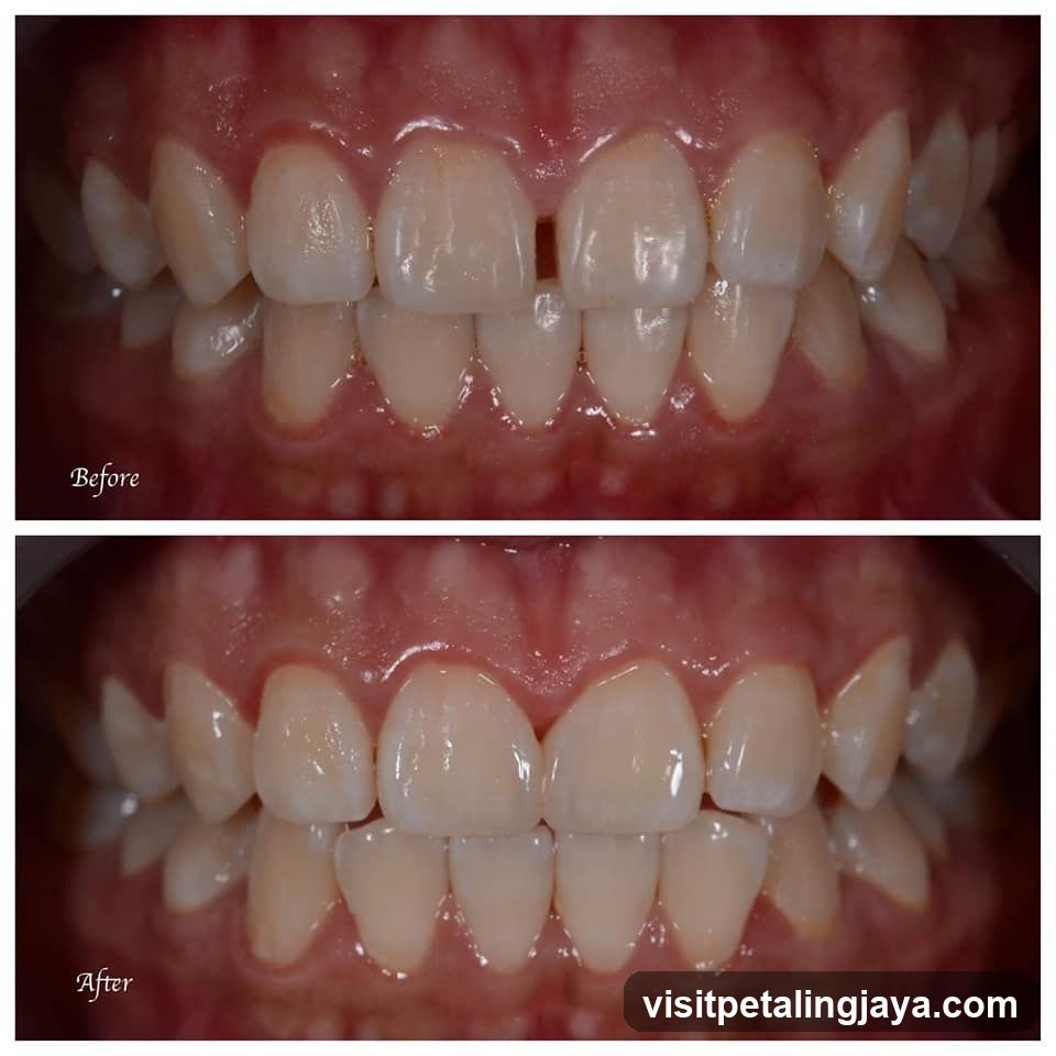 Before and After Dental Treatment