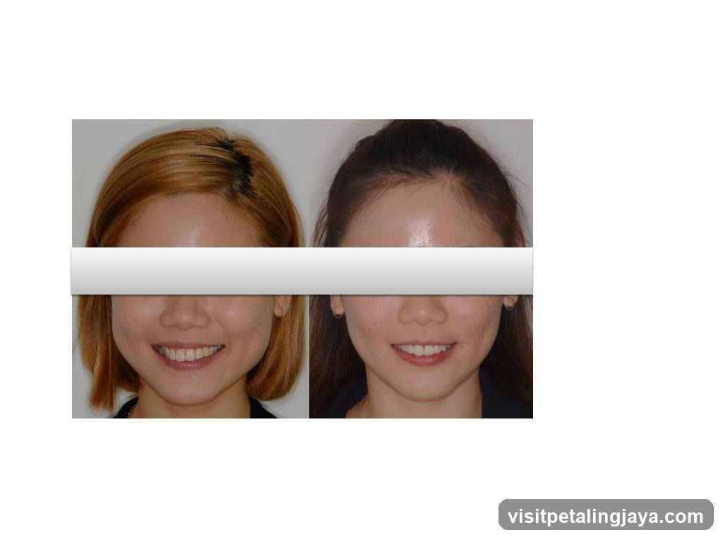 Before and After Facial Comparison
