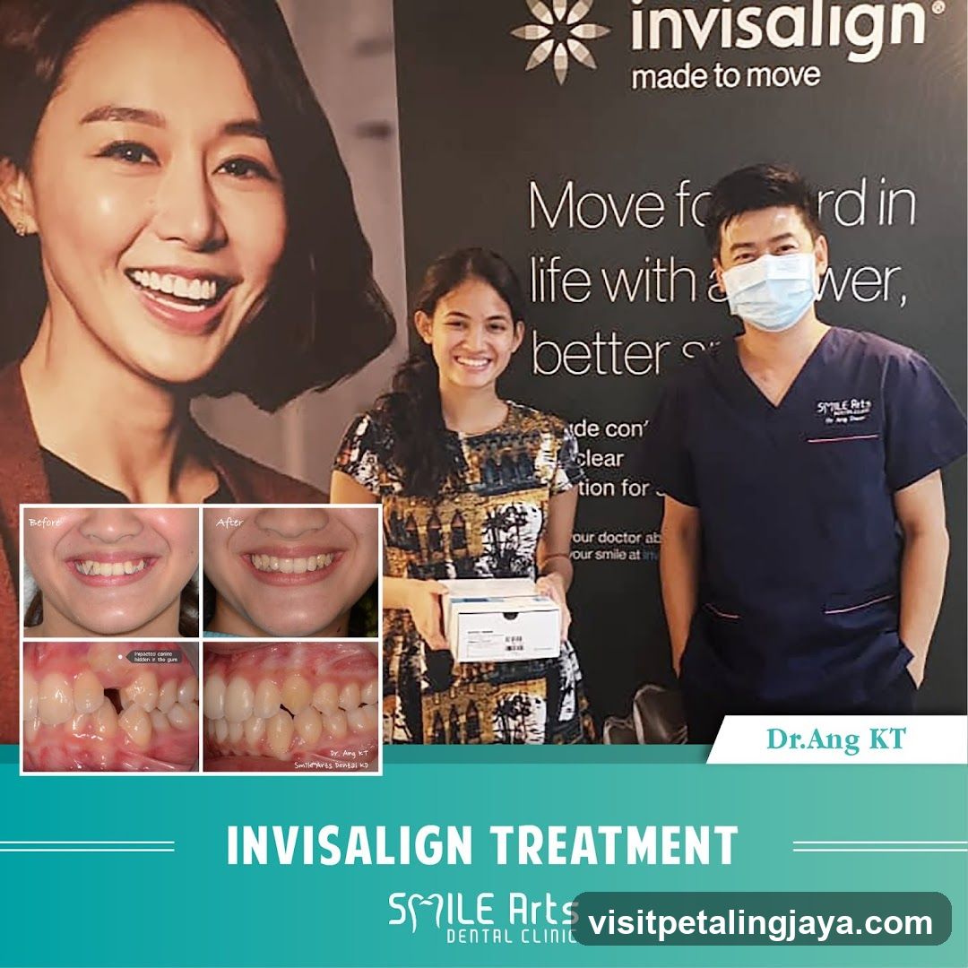 Invisalign Treatment Advertisement