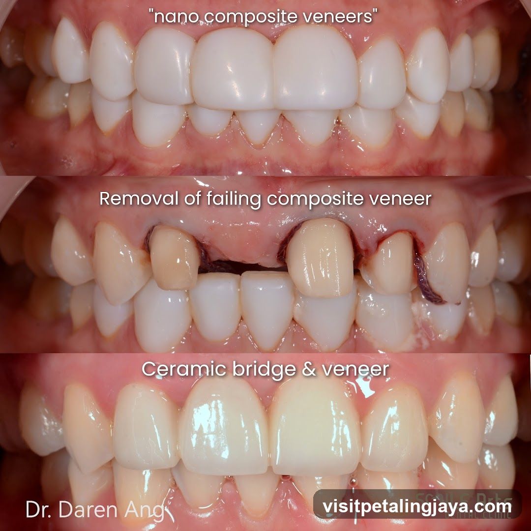 Dental Treatment Comparison