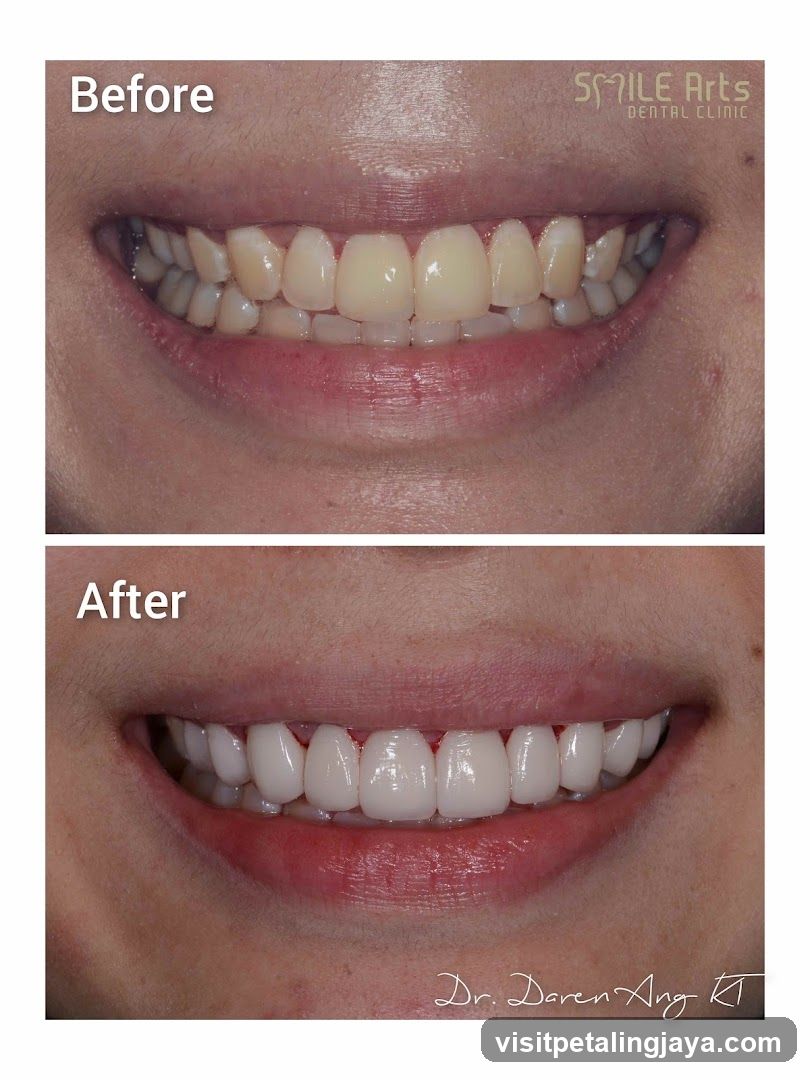 Dental Before and After