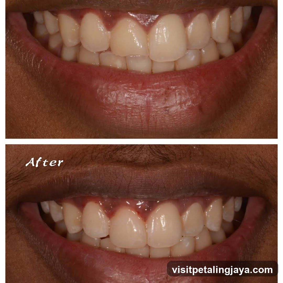 Dental Smile After Treatment