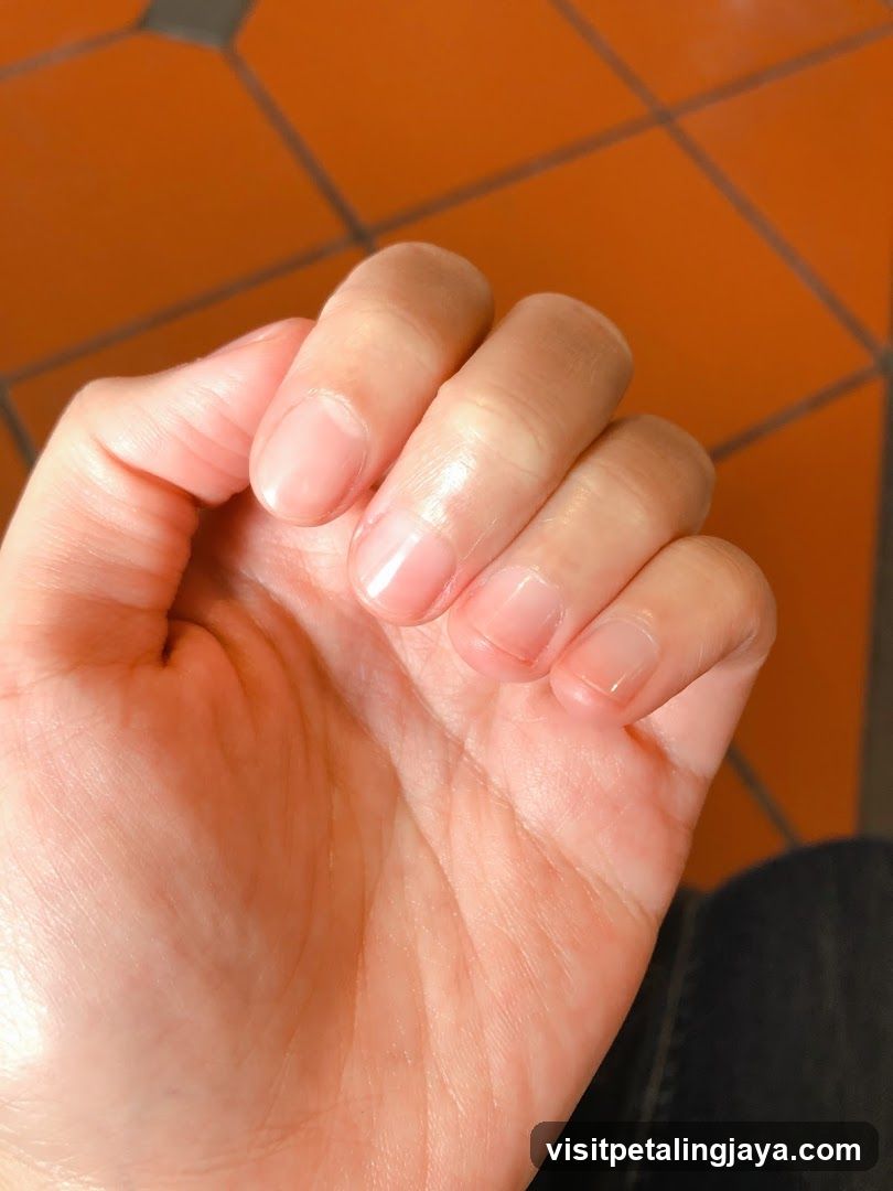 Hand with short nails