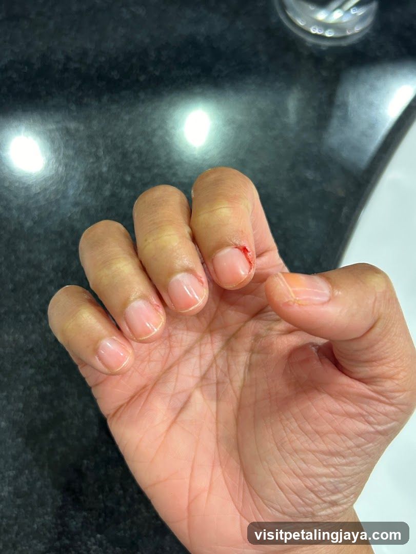 Hand with minor injury