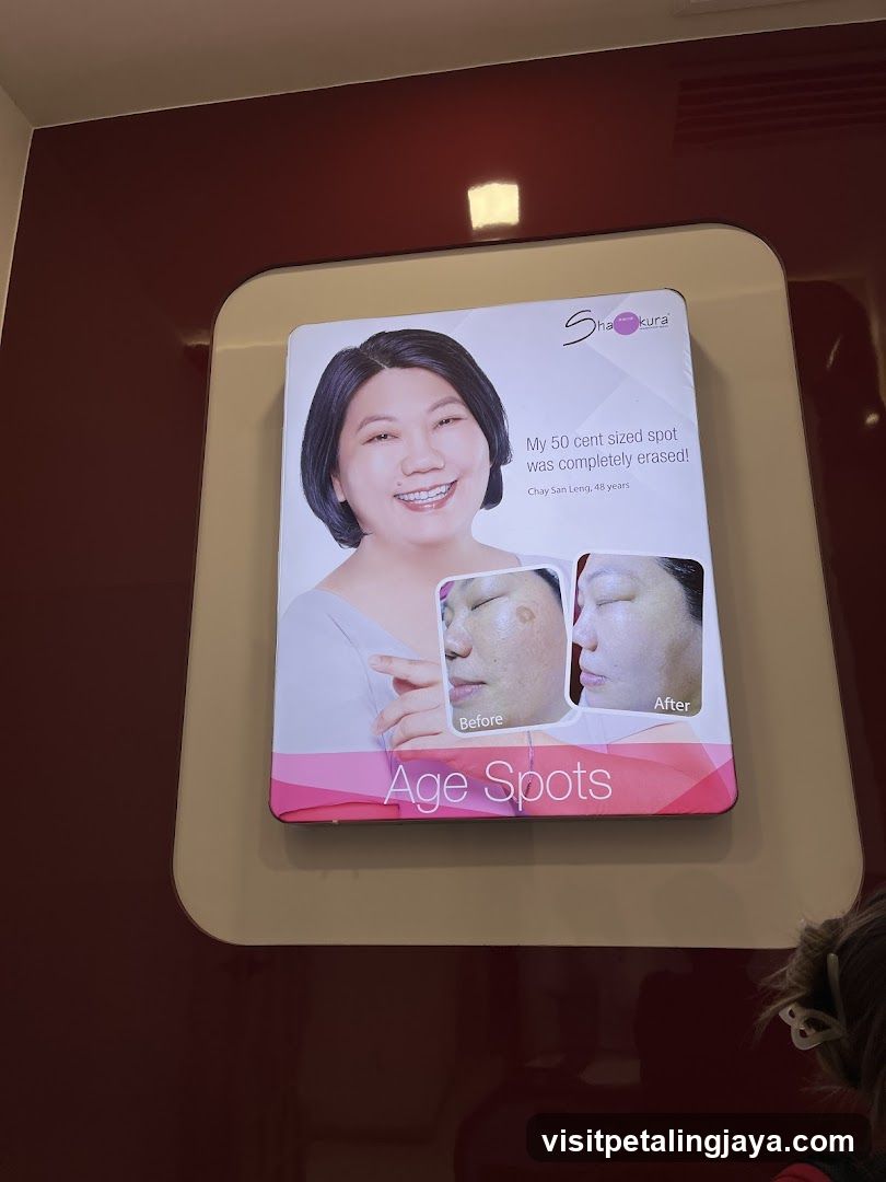 Age Spots Advertisement